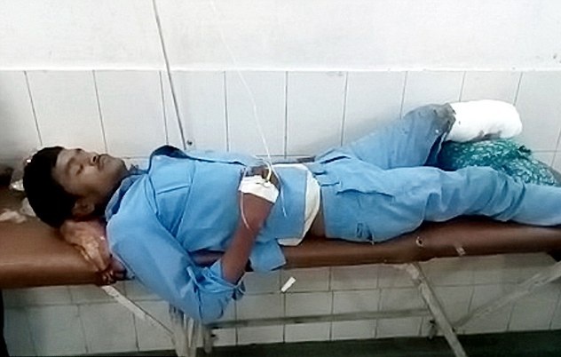 惊悚！印度一男子遭车祸截肢 将断肢当枕头