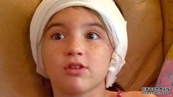 美女孩动物园观光遭袋鼠咬伤 母亲怒诉园方求赔偿