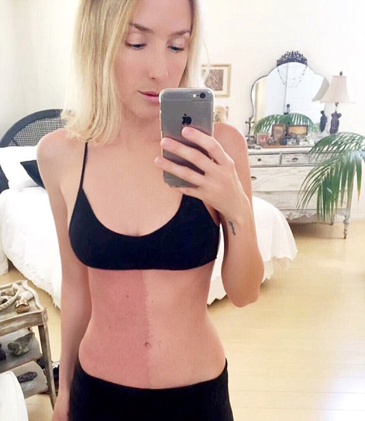 “我是自己的双胞胎”！美女模特竟是“嵌合体人” 拥有两套DNA