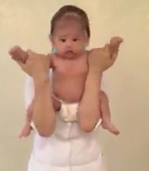 震惊！哈萨克斯坦按摩师扯婴儿四肢旋转称是治疗
