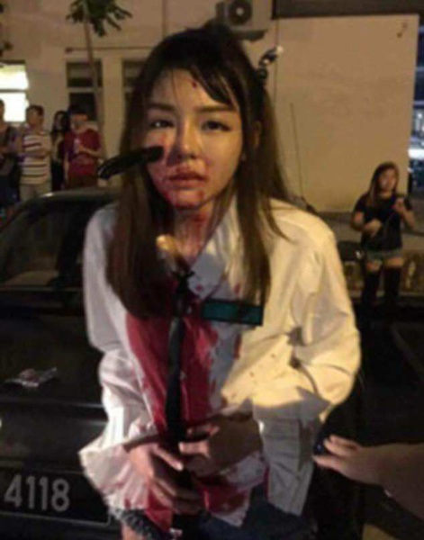 凶残！马来西亚女子反抗抢劫右脸被劫匪插进一把刀