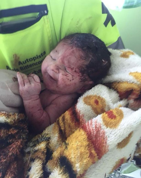巴西孕妇遭严重车祸 胎儿被甩出子宫奇迹存活