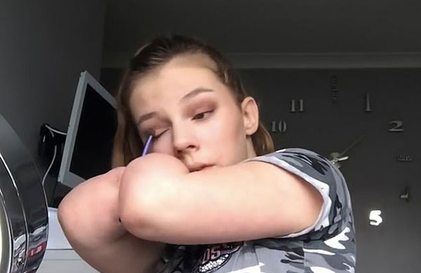 励志！英15岁女生因病失去四肢化妆技巧娴熟