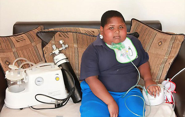 南非11岁男童患肥胖症去世 饿了连卫生纸都吃