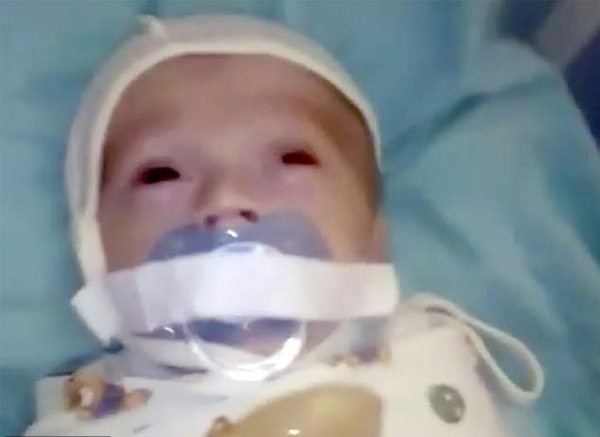 俄医院12周大婴儿遭胶带强行固定奶嘴叫人心疼