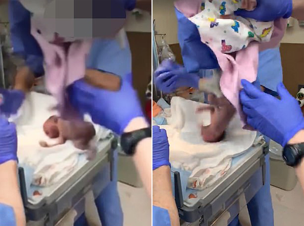 美一女婴出生时从医生手中滑落导致后脑内出血