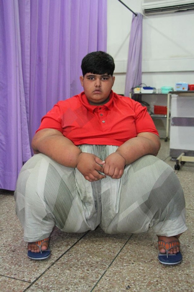 世界最胖男孩10岁近400斤饭量相当于四个成人
