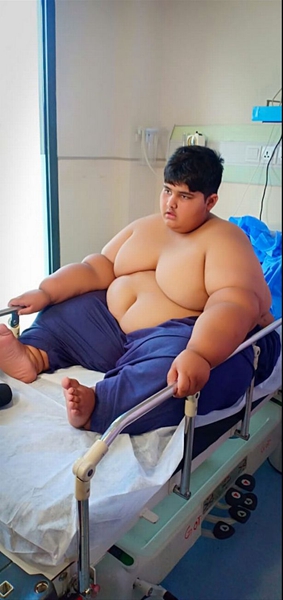 世界最胖男孩10岁近400斤饭量相当于四个成人