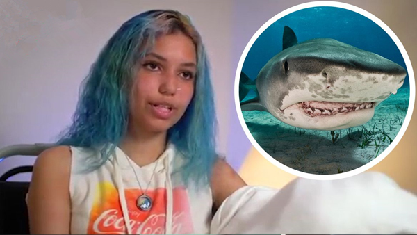 美国少女遭鲨鱼袭击 英雄老爸捶打鲨鱼救女儿