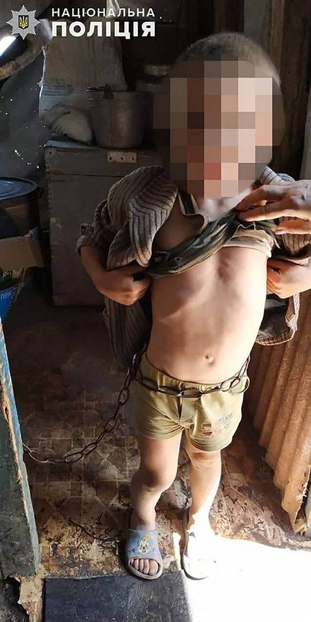 乌克兰六岁男童遭父亲虐待 被铁链捆绑栓在门上