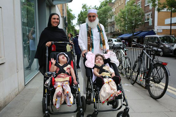 巴基斯坦连体双胞胎姐妹在伦敦分离头部 成功存活