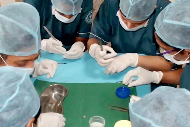 印度一7岁男孩下巴肿胀 医生从其口中拔出526颗“牙齿”