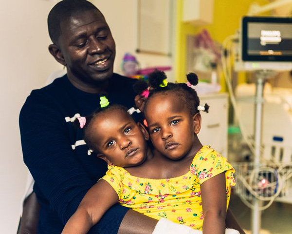 塞内加尔一父亲面临生死抉择 连体女儿只能救一个