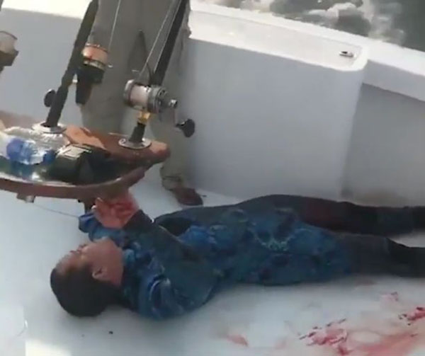 美国一男子游泳时被鲨鱼咬伤 血迹斑斑爬上救援船