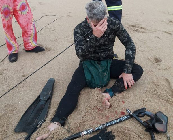 南非一男子海中潜水时不幸用捕鱼枪射穿自己头部
