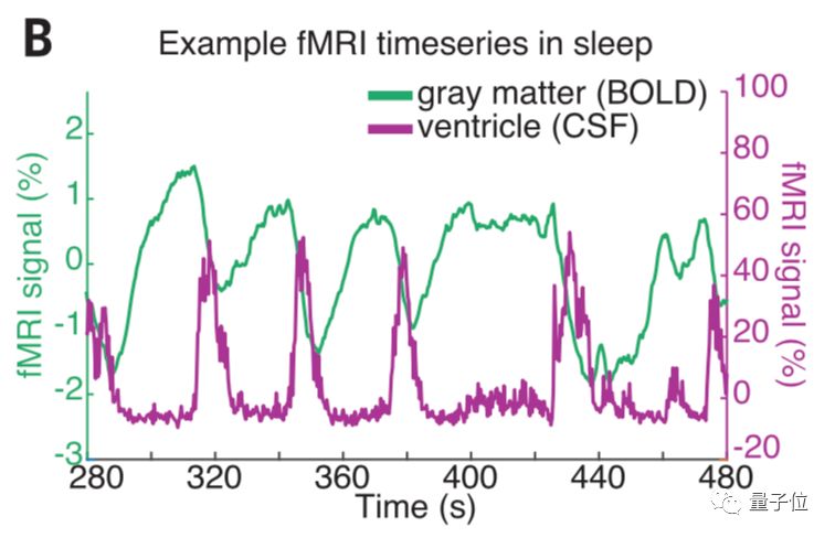 熬夜变傻有依据:人类睡觉时会被＂洗脑＂ 科学家拍下全程